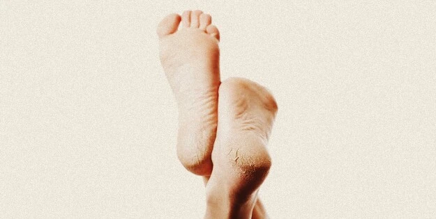 Crack Heel Repair Tips – Home Remedy
