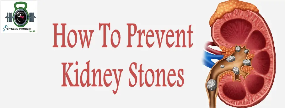 How To Prevent Kidney Stones? Its Treatment